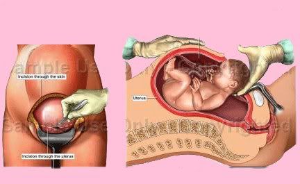 الحمل والولادة
